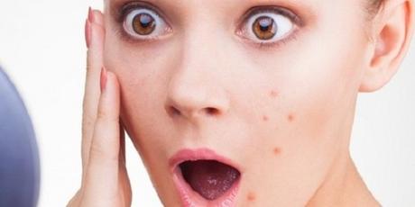 Tips on how to get rid of black spots on the face