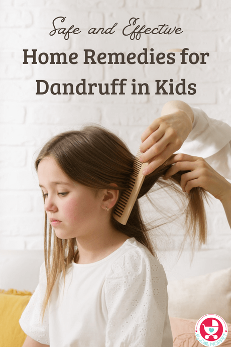 These Home Remedies for Dandruff are natural and effective, and completely safe for use in children. Fix dandruff without harmful chemicals!
