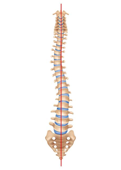 Postural Dysfunction Scoliosis