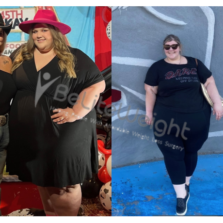 Lauren’s 6 Month Update-Down 115 Pounds
