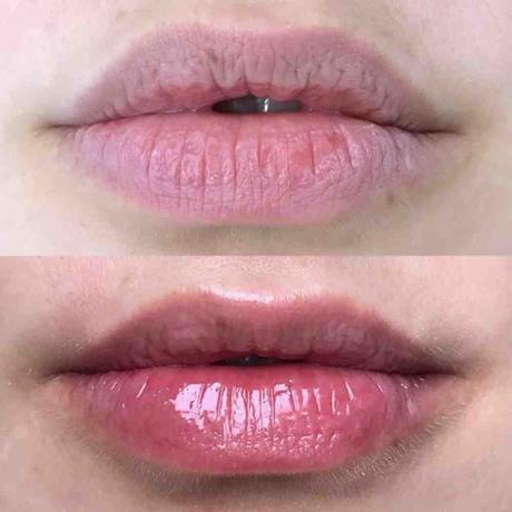 5 home remedies to combat chapped lips in cold season