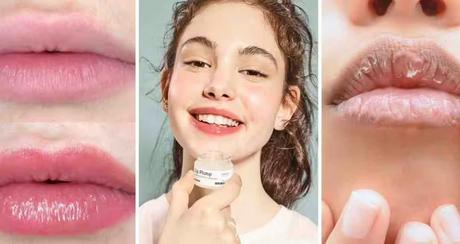 5 home remedies to combat chapped lips in cold season