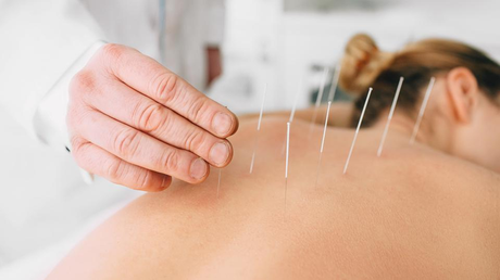 How To Find & Choose Best Acupuncturist?