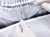 Tooth Decay: Symptoms, Causes, Treatment