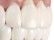 What Link Between Teeth Whitening Recession?