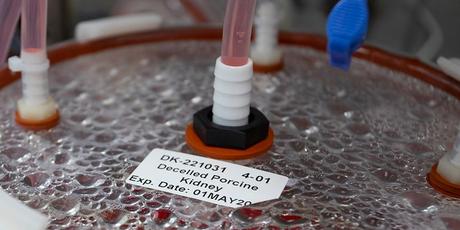 Making pig livers humanlike in quest to ease organ shortage 6 A label on a bioreactor indicates it contains a pig kidney in a Micromatrix laboratory on Tuesday, Dec. 8, 2022, in Eden Prairie, Minn.