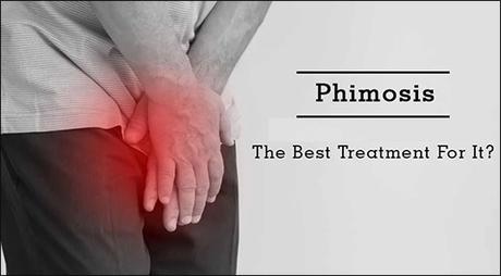 How Can Phimosis Be Managed In Ayurveda With Herbal Remedies?