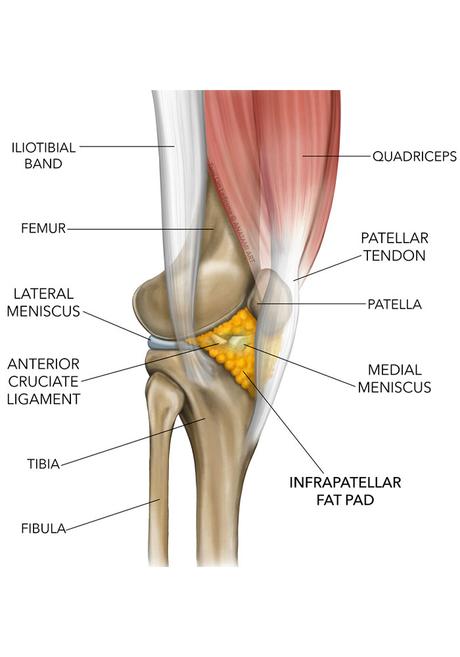 Infrapatellar Fat Pad Syndrome