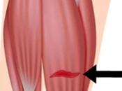 Hamstring Muscle Injury