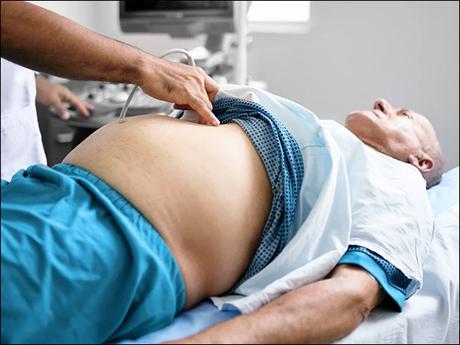 What is Ascites? – Types, Symptoms, Causes and Herbal Remedies