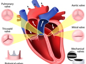 Signs Heart Disease