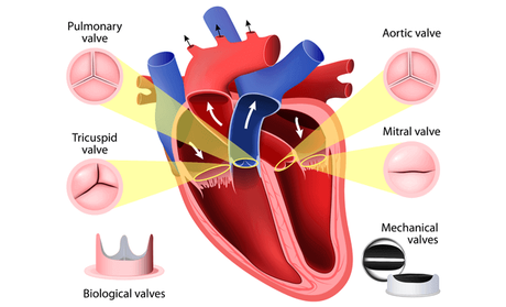 Signs of Heart Disease