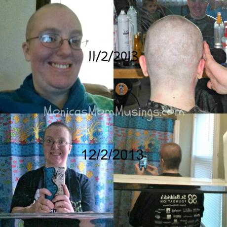 After shaving one month later