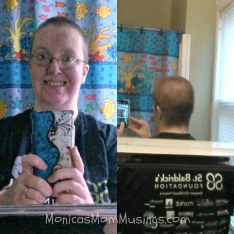 One month after shaving