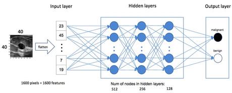 AI Research Enables Big Data For Detecting Rare Cancer