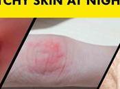 Uncover Mystery Your Itchy Skin Night: Question Enough!