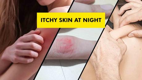 Uncover-the-Mystery-of-Your-Itchy-Skin-at-Night--23-Question-is-Enough!-Uncover-the-Mystery-of-Your-Itchy-Skin-at-Night-23-Question-is-Enough!