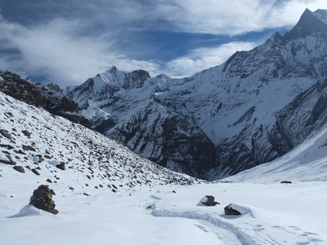 Altitude sickness in Annapurna Base Camp