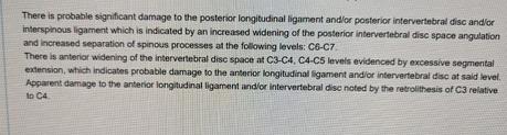 The Cervical Anterior Longitudinal Ligament (ALL) Injuries: All You Need To Know – Centeno-Schultz Clinic