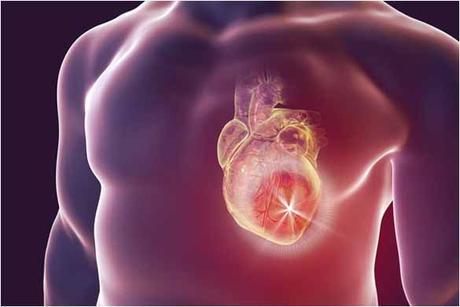 Herbal Remedies For Hypertrophic Cardiomyopathy Herbal Remedies For Hypertrophic Cardiomyopathy