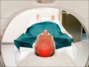 Central Pontine Myelinolysis its Treatment with Ayurveda