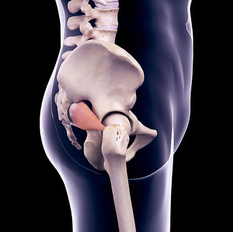 Piriformis Syndrome