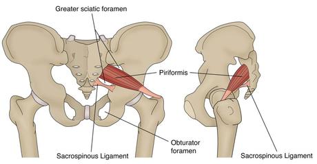 Piriformis Syndrome