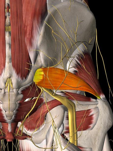 Piriformis Syndrome