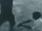 Severs Both Hands Electrician Moratuwa