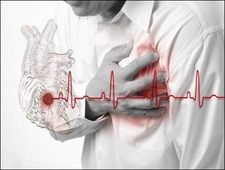 What is Heart Attack? Causes and Effects — Heart Care Pack