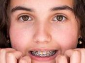 Things Know Before Getting Dental Braces