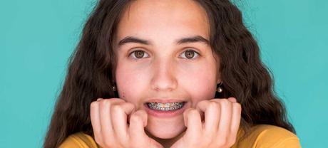 11 Things to Know Before Getting Dental Braces