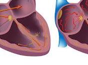 During Atrial Fibrillation, Chambers Heart Beat Chaotically Irregularly, Goes Rhythm With Bottom