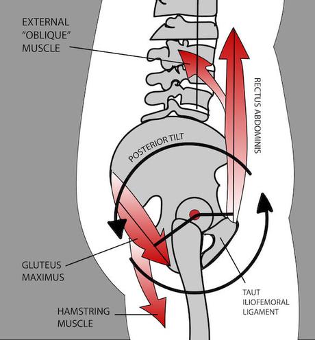 Pelvic Rotation: Causes, Symptoms, Treatment