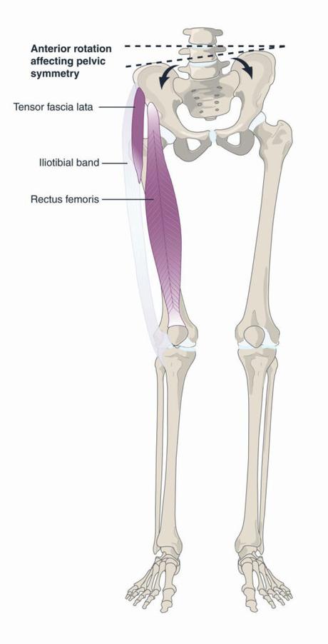 Pelvic Rotation: Causes, Symptoms, Treatment