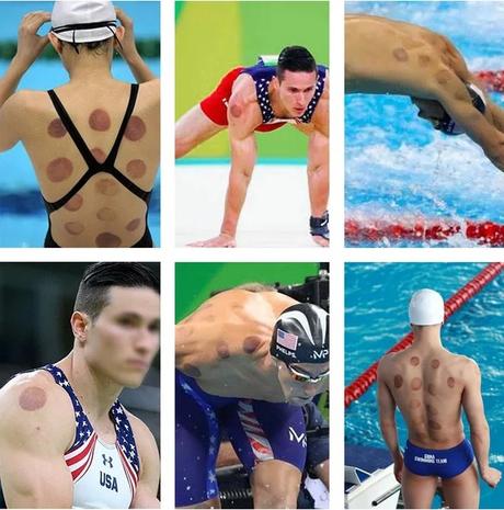 SAVE - Professional Chinese Acupoint Cupping Therapy Sets