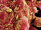 Clinical Trial Shows Remdesivir Accelerates Recovery from Advanced COVID-19