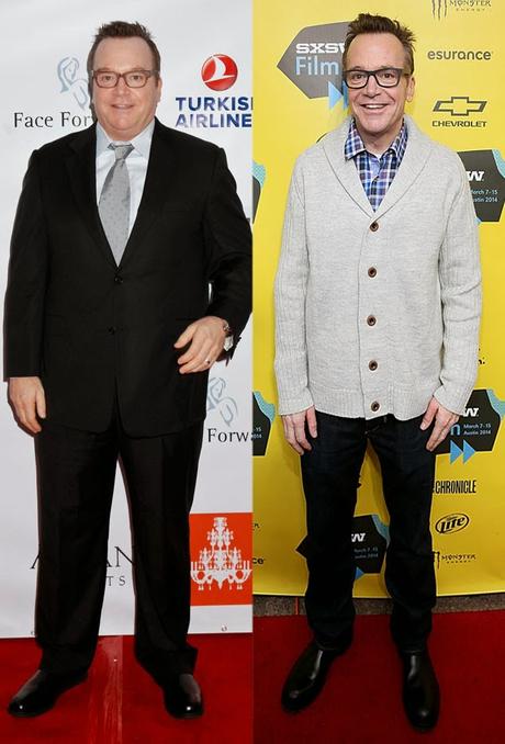 Tom Arnold Shows Off Extreme 89-Pound Weight Loss at SXSW—See the Pic! Tom Arnold Shows Off Extreme 89-Pound Weight Loss at SXSW—See the Pic!
