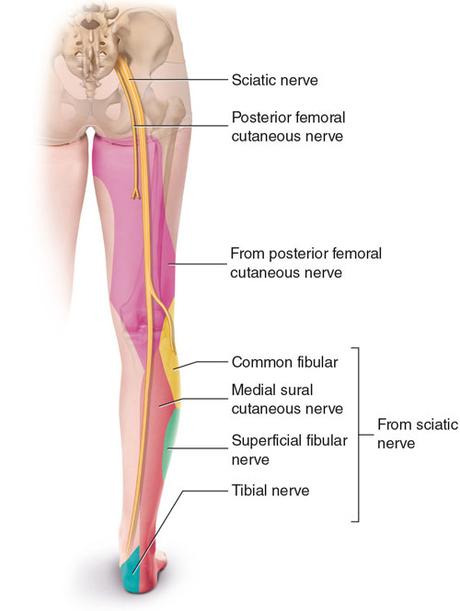 Sciatica, Causes, Signs and Symptoms, Diagnosis and Treatment 4 SCIATICA