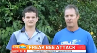 freak bee attack