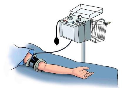 Surgical Tourniquets Market