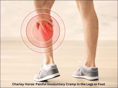 What is Charley horse? How can Ayurveda help?