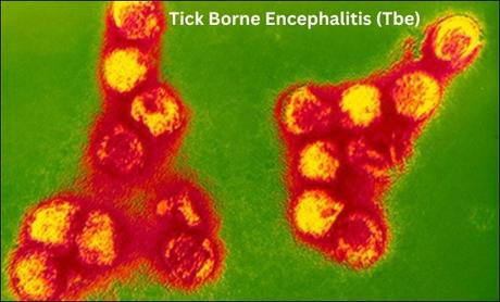Tick Borne Encephalitis (Tbe)- Treatment With Herbal Products