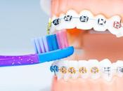 Which Best Braces Colors?