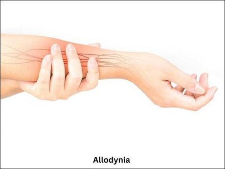 Allodynia – Causes, Symptoms, and Treatment in Ayurveda