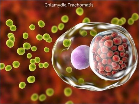Chlamydia Trachomatis Treatment in Ayurveda