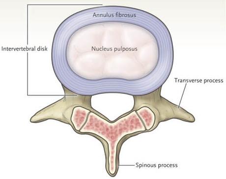 Degenerative Changes Of The Thoracic Spine