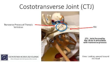 Degenerative Changes Of The Thoracic Spine