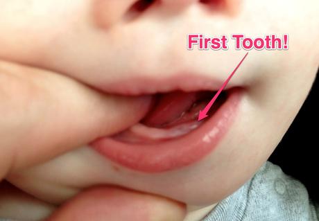 7 Signs of Teething in Babies