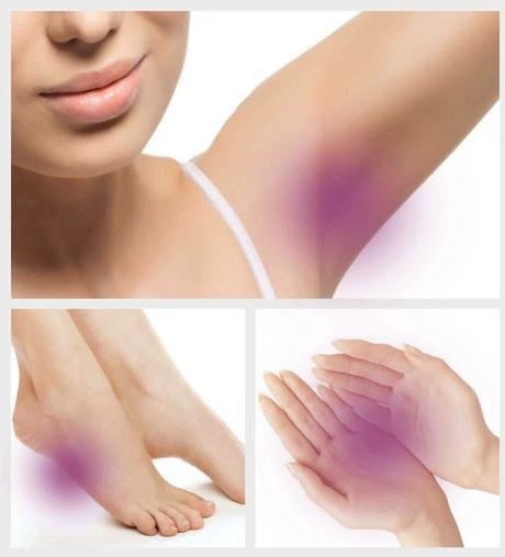 Hyperhidrosis Treatment